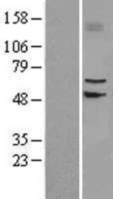 Western Blot: SLC39A4/ZIP4 Overexpression Lysate (Adult Normal) [NBL1-16147] Left-Empty vector transfected control cell lysate (HEK293 cell lysate); Right -Over-expression Lysate for SLC39A4/ZIP4.