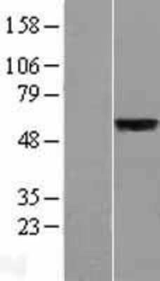 Western Blot: SLC39A5 Overexpression Lysate (Adult Normal) [NBL1-16149] Left-Empty vector transfected control cell lysate (HEK293 cell lysate); Right -Over-expression Lysate for SLC39A5.