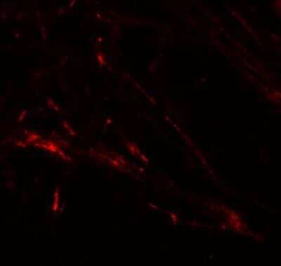 Immunocytochemistry/Immunofluorescence: SLC39A7/ZIP7 Antibody [NBP1-76504] - Immunofluorescence of ZIP7 in human brain tissue with ZIP7 antibody at 20 ug/mL.