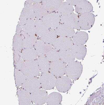 Immunohistochemistry-Paraffin: SLC39A7/ZIP7 Antibody [NBP2-13338] - Staining of human skeletal muscle shows no positivity in myocytes as expected.