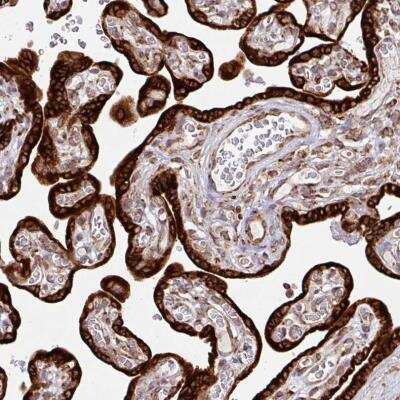 Immunohistochemistry-Paraffin: SLC39A7/ZIP7 Antibody [NBP2-13338] -  Staining of human placenta shows granular cytoplasmic positivity in trophoblastic cells.