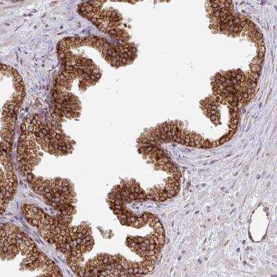 Immunohistochemistry-Paraffin: SLC39A7/ZIP7 Antibody [NBP2-13338] - Staining of human prostate shows granular cytoplasmic positivity in glandular cells.