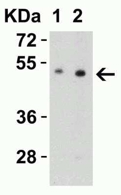 Western Blot: SLC39A7/ZIP7 Antibody [NBP1-76504] - Western Blot Validation in Mouse Brain Tissue Lysate. Loading: 15 ug of lysates per lane. Antibodies: ZIP7, NBP1-76504 (Lane 1: 0.5 ug/mL and Lane 2: 1 ug/mL), 1h incubation at RT in 5% NFDM/TBST. Secondary: Goat anti-rabbit IgG HRP conjugate at 1:10000 dilution.