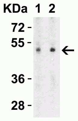 Western Blot: SLC39A7/ZIP7 Antibody [NBP1-76504] - Western Blot Validation in Rat Brain Tissue Lysate. Loading: 15 ug of lysates per lane. Antibodies: ZIP7, NBP1-76504 (Lane 1: 0.5 ug/mL and Lane 2: 1 ug/mL), 1h incubation at RT in 5% NFDM/TBST. Secondary: Goat anti-rabbit IgG HRP conjugate at 1:10000 dilution.