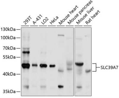 Western Blot: SLC39A7/ZIP7 Antibody [NBP2-94849] - Analysis of extracts of various cell lines, using SLC39A7/ZIP7 at 1:1000 dilution. Secondary antibody: HRP Goat Anti-Rabbit IgG (H+L) at 1:10000 dilution. Lysates/proteins: 25ug per lane. Blocking buffer: 3% nonfat dry milk in TBST. Detection: ECL Basic Kit . Exposure time: 20s.