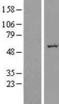 Western Blot: SLC39A7/ZIP7 Overexpression Lysate (Adult Normal) [NBL1-16150] Left-Empty vector transfected control cell lysate (HEK293 cell lysate); Right -Over-expression Lysate for SLC39A7/ZIP7.