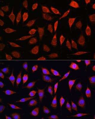 Immunocytochemistry/Immunofluorescence: SLC39A8/ZIP8 Antibody [NBP2-93479] - Analysis of L929 cells using ZIP8 Rabbit pAb at dilution of 1:100. Blue: DAPI for nuclear staining.