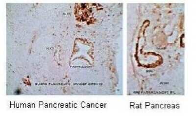 Immunohistochemistry-Paraffin: SLC39A8/ZIP8 Antibody [NBP1-59601] - Human Pancreas (Cancer) & rat pancreas, 6.6 ug/ml.