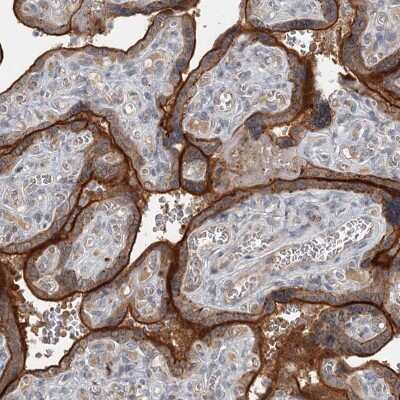 Immunohistochemistry-Paraffin: SLC39A8/ZIP8 Antibody [NBP1-88605] - Staining of human placenta shows distinct membranous positivity in syncytiotrophoblasts.