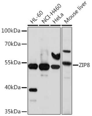 Western Blot SLC39A8/ZIP8 Antibody - BSA Free