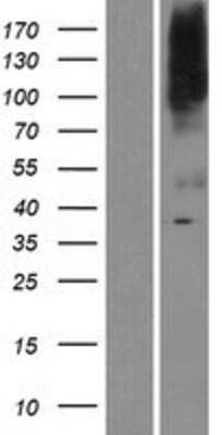 Western Blot: SLC39A8/ZIP8 Overexpression Lysate (Adult Normal) [NBP2-04389] Left-Empty vector transfected control cell lysate (HEK293 cell lysate); Right -Over-expression Lysate for SLC39A8/ZIP8.