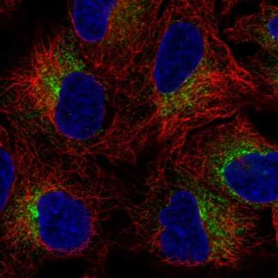 Immunocytochemistry/Immunofluorescence: SLC39A9/ZIP9 Antibody [NBP2-57957] - Staining of human cell line A549 shows localization to endoplasmic reticulum.