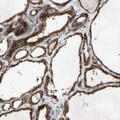 Immunohistochemistry-Paraffin: SLC39A9/ZIP9 Antibody [NBP1-83760] - Staining of human thyroid gland shows high expression.