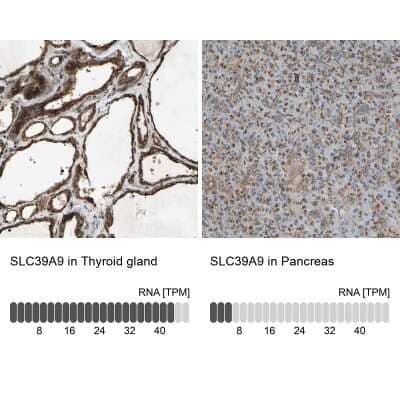 Immunohistochemistry-Paraffin: SLC39A9/ZIP9 Antibody [NBP1-83760] - Staining in human thyroid gland and pancreas tissues using anti-SLC39A9 antibody. Corresponding SLC39A9 RNA-seq data are presented for the same tissues.