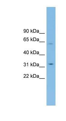 Western Blot: SLC39A9/ZIP9 Antibody [NBP1-59841] - U937 cell lysate, concentration 0.2-1 ug/ml.