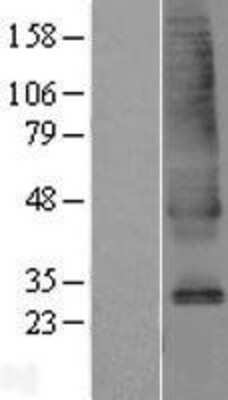 Western Blot: SLC39A9/ZIP9 Overexpression Lysate (Adult Normal) [NBL1-16152] Left-Empty vector transfected control cell lysate (HEK293 cell lysate); Right -Over-expression Lysate for SLC39A9/ZIP9.