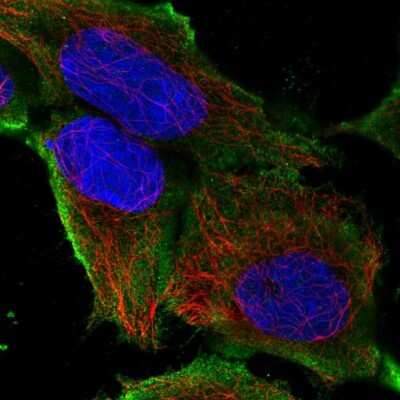 Immunocytochemistry/Immunofluorescence: SLC41A3 Antibody [NBP2-48837] - Staining of human cell line HEK 293 shows localization to plasma membrane.