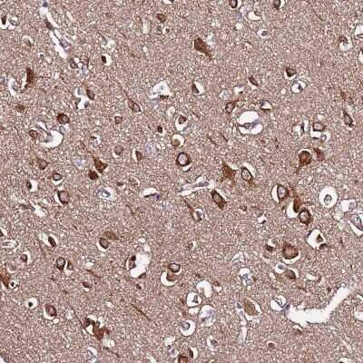 Immunohistochemistry-Paraffin: SLC41A3 Antibody [NBP2-48837] - Staining of human cerebral cortex shows strong cytoplasmic positivity in neuronal and glial cells.