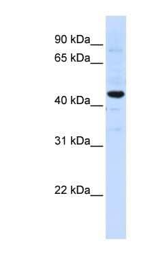 Western Blot: SLC41A3 Antibody [NBP1-59764] - Hela cell lysate, concentration 0.2-1 ug/ml.
