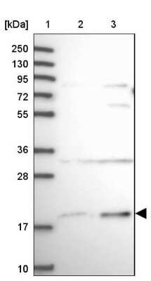 Western Blot: SLC41A3 Antibody [NBP2-48837] - Lane 1: Marker [kDa] 250, 130, 95, 72, 55, 36, 28, 17, 10Lane 2: Human cell line RT-4Lane 3: Human cell line U-251MG sp