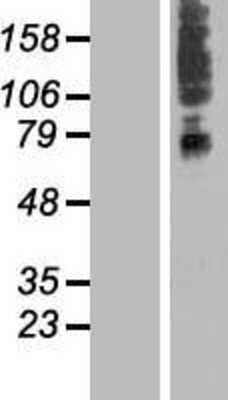 Western Blot: SLC41A3 Overexpression Lysate (Adult Normal) [NBL1-16156] Left-Empty vector transfected control cell lysate (HEK293 cell lysate); Right -Over-expression Lysate for SLC41A3.