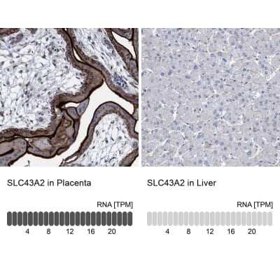 Immunohistochemistry-Paraffin: SLC43A2 Antibody [NBP1-82706] - Staining in human placenta and liver tissues using anti-SLC43A2 antibody. Corresponding SLC43A2 RNA-seq data are presented for the same tissues.