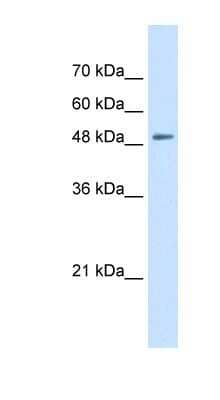 Western Blot: SLC43A2 Antibody [NBP1-59373] - Jurkat cell lysate, concentration 0.2-1 ug/ml.