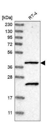 Western Blot: SLC43A2 Antibody [NBP1-82706] - Analysis in human cell line RT-4.