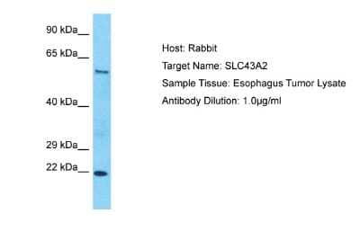 Western Blot: SLC43A2 Antibody [NBP2-85759] - Host: Rabbit. Target Name: SLC43A2. Sample Type: Esophagus Tumor lysates. Antibody Dilution: 1.0ug/ml
