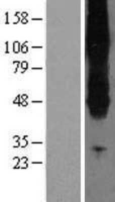 Western Blot: SLC43A2 Overexpression Lysate (Adult Normal) [NBL1-16158] Left-Empty vector transfected control cell lysate (HEK293 cell lysate); Right -Over-expression Lysate for SLC43A2.