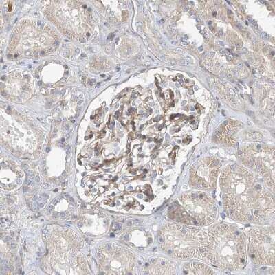 Immunohistochemistry-Paraffin SLC43A3 Antibody