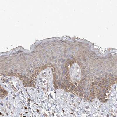 Immunohistochemistry-Paraffin: SLC43A3 Antibody [NBP1-85026] - Staining of human skin shows weak to moderate cytoplasmic positivity in squamous epithelial cells.