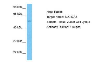 Western Blot: SLC43A3 Antibody [NBP2-88307] - Host: Rabbit. Target Name: SLC43A3. Sample Type: Jurkat Whole Cell lysates. Antibody Dilution: 1.0ug/ml