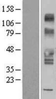 Western Blot: SLC43A3 Overexpression Lysate (Adult Normal) [NBP2-09882] Left-Empty vector transfected control cell lysate (HEK293 cell lysate); Right -Over-expression Lysate for SLC43A3.
