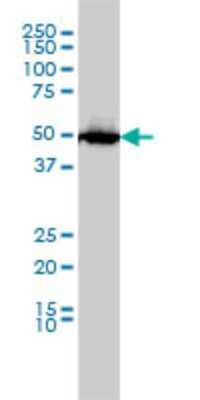 Western Blot: SLC45A2 Antibody (2F4) [H00051151-M01] - MATP monoclonal antibody (M01), clone 2F4 Analysis of MATP expression in HL-60.