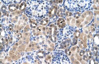 Immunohistochemistry-Paraffin: SLC46A3 Antibody [NBP1-80531] - Human kidney Tissue, antibody concentration 4-8ug/ml. Cells with positive label: renal corpuscle cells (indicated with arrows) 400X magnification.