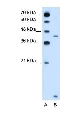 Western Blot: SLC46A3 Antibody [NBP1-80531] - Jurkat cell lysate, Antibody Titration: 2.5ug/ml