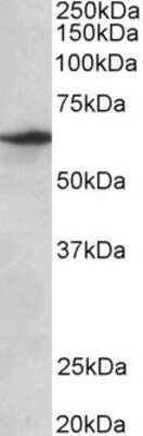 Western Blot SLC47A2 Antibody