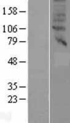 Western Blot: SLC47A2 Overexpression Lysate (Adult Normal) [NBP2-05295] Left-Empty vector transfected control cell lysate (HEK293 cell lysate); Right -Over-expression Lysate for SLC47A2.