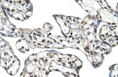Immunohistochemistry-Paraffin: SLC48A1 Antibody [NBP1-91563] - Human Placenta Decidual cells (indicated with arrows), 4-8ug/ml.