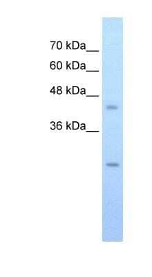 Western Blot: SLC48A1 Antibody [NBP1-91563] - HepG2 cell lysate, Antibody Titration: 0.0625ug/ml