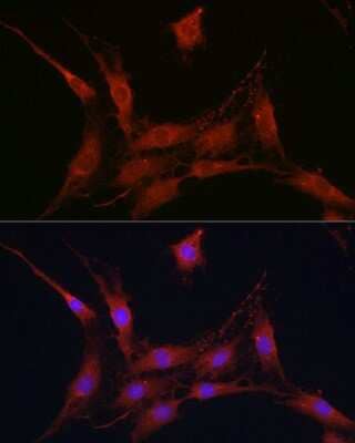 Immunocytochemistry/Immunofluorescence: SLC4A4 Antibody [NBP2-94138] - Immunofluorescence analysis of C6 cells using SLC4A4 Rabbit pAb (NBP2-94138) at dilution of 1:100 (40x lens). Blue: DAPI for nuclear staining.