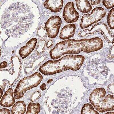 Immunohistochemistry-Paraffin: SLC4A4 Antibody [NBP2-32021] - Staining of human kidney shows strong cytoplasmic and membranous positivity in cells in tubules.