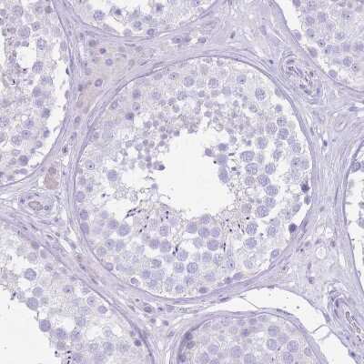 Immunohistochemistry-Paraffin: SLC4A4 Antibody [NBP2-32020] - Staining of human testis shows no positivity in cells in seminiferous ducts as expected.