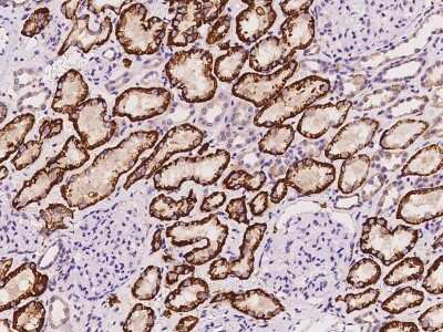 Immunohistochemistry-Paraffin: SLC4A4 Antibody [NBP2-98469] - Staining of human SLC4A4 in human kidney with rabbit polyclonal antibody at 1:100 dilution.