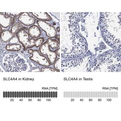 Immunohistochemistry-Paraffin: SLC4A4 Antibody [NBP3-17023] - Analysis in human kidney and testis tissues using Anti-SLC4A4 antibody. Corresponding SLC4A4 RNA-seq data are presented for the same tissues.