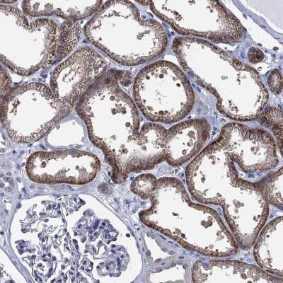 Immunohistochemistry-Paraffin: SLC4A4 Antibody [NBP3-17023] - Staining of human kidney shows high expression.