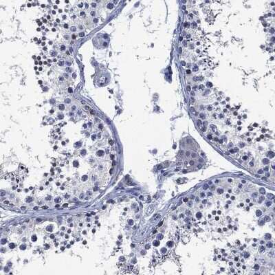 Immunohistochemistry-Paraffin: SLC4A4 Antibody [NBP3-17023] - Staining of human testis shows low expression as expected.