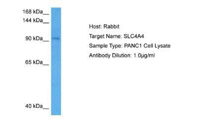 Western Blot: SLC4A4 Antibody [NBP2-88308] - Host: Rabbit. Target Name: SLC4A4. Sample Tissue: Human PANC1 Whole Cell lysates. Antibody Dilution: 1ug/ml