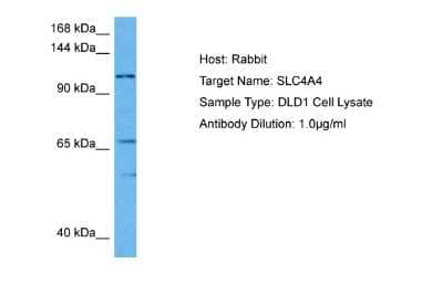 Western Blot: SLC4A4 Antibody [NBP2-88309] - Host: Rabbit. Target Name: SLC4A4. Sample Tissue: Human DLD1 Whole Cell lysates. Antibody Dilution: 1ug/ml